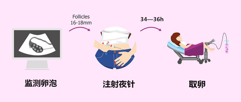 取卵后都会有腹水吗？解析取卵手术后的常见并发症及应对措施