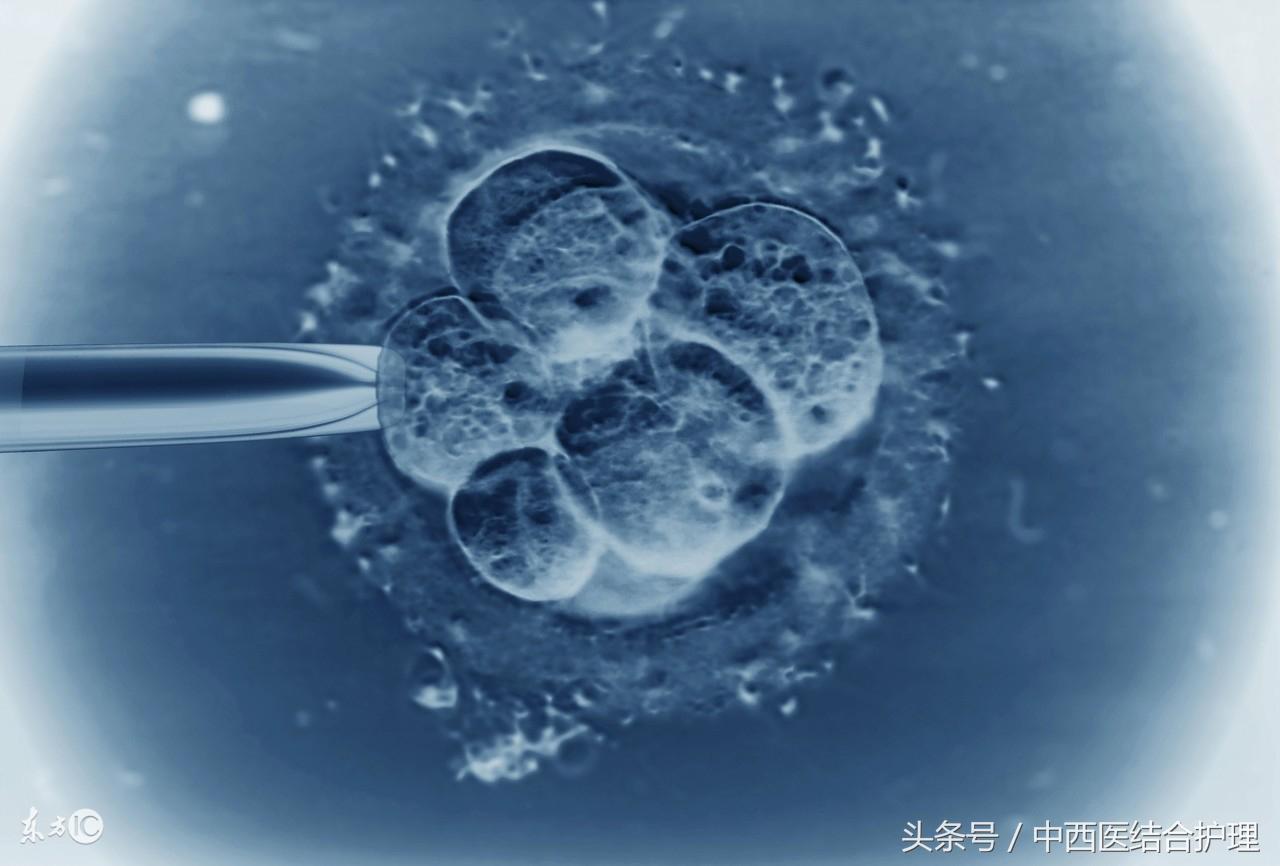 试管婴儿技术中的取卵过程，理解、准备与关怀